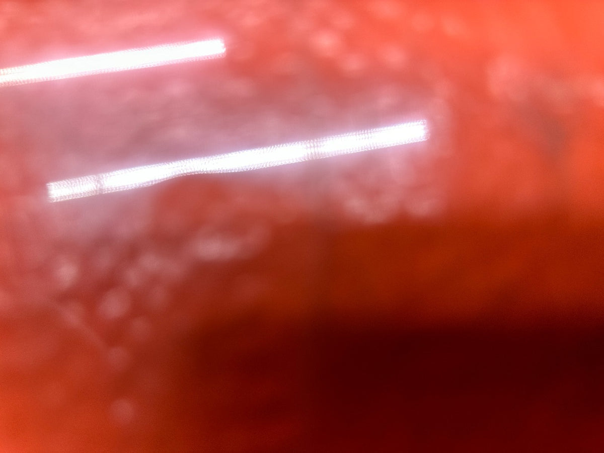 epi